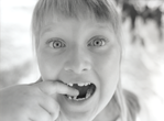 photograph of girl missing teeth